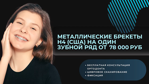 Брекеты со скидкой