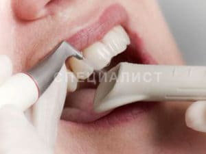 Ультразвуковая чистка зубов Air flow